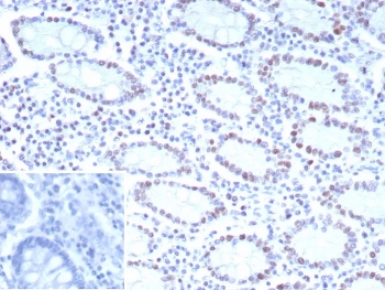 IHC staining of FFPE human colon tissue with CDK4 antibody (clone CDK4/8895). Inset: PBS used in place of primary Ab (secondary Ab negative control). HIER: boil tissue sections in pH 9 10mM Tris with 1mM EDTA for 20 min and allow to cool before testing.
