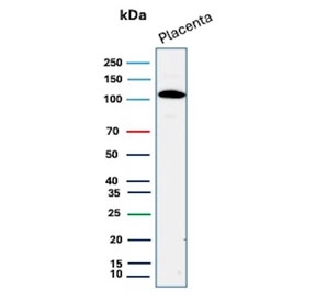 Western blot testing of human placental tissue lysate with recombinant E-Cadherin antibody. Expected molecular weight: 135 kDa (precursor), 80-120 kDa (mature, depending on glycosylation level).