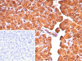IHC staining of FFPE human pancreas tissue with Carboxypeptidase A1 antibody (clone CPA1/8777). Inset: PBS used in place of primary Ab (secondary Ab negative control). HIER: boil tissue sections in pH 9 10mM Tris with 1mM EDTA for 20 min and allow to cool before testing.