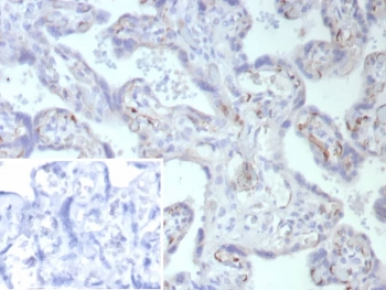 IHC staining of FFPE human placental tissue with Fatty Acid Binding Protein 4 antibody (clone FABP4/9086R). Inset: PBS used in place of primary Ab (secondary Ab negative control). HIER: boil tissue sections in pH 9 10mM Tris with 1mM EDTA for 20 min and allow to cool before testing.