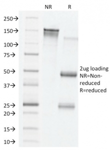 SDS-PAGE analysis of purified, BSA-free VEGF antibody (clone VG76e) as confirmation of integrity and purity.
