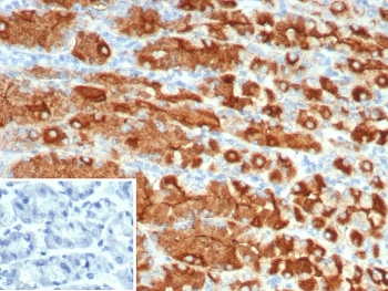 IHC staining of FFPE human stomach tissue with recombinant MUC1 antibody (clone r115D8). Inset: PBS used in place of primary Ab (secondary Ab negative control). HIER: boil tissue sections in pH 9 10mM Tris with 1mM EDTA for 20 min and allow to cool before testing.