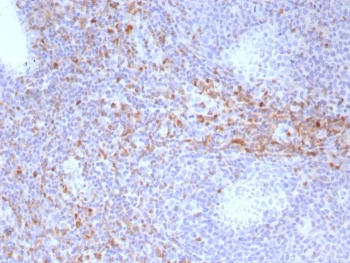 IHC staining of FFPE human tonsil tissue with CD44v6 antibody (clone HCAM/6779). HIER: boil tissue sections in pH 9 10mM Tris with 1mM EDTA for 20 min and allow to cool before testing.