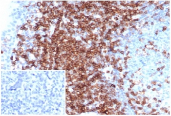 IHC staining of FFPE human tonsil tissue with CD43 antibody (clone MT-1). Inset: PBS instead of primary antibody, secondary negative control. HIER: boil tissue sections in pH 9 10mM Tris with 1mM EDTA for 20 min and allow to cool before testing.