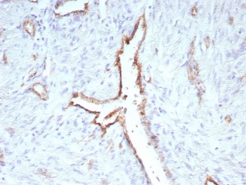 IHC staining of FFPE human uterus tissue with recombinant CD31 antibody (clone C31/9224R). HIER: boil tissue sections in pH 9 10mM Tris with 1mM EDTA for 20 min and allow to cool before testing.