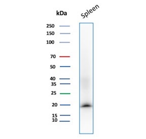 Western blot testing of human spleen tissue with Stathmin 1 antibody (clone STMN1/8437). Predicted molecular weight ~17 kDa.