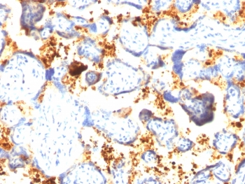 IHC staining of FFPE human placental tissue with Transglutaminase 2 antibody (clone SPM358). HIER: boil tissue sections in pH 9 10mM Tris with 1mM EDTA for 20 min and allow to cool before testing.