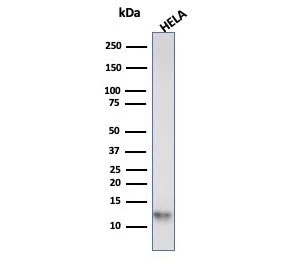 Western blot analysis of HeLa cell lysate using S100A4 antibody (clone S100A4/6799). Predicted molecular weight ~12 kDa.