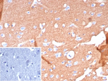 IHC staining of FFPE human brain tissue with recombinant CD171 antibody (clone L1CAM/9267R). Inset: PBS used in place of primary Ab (secondary Ab negative control). HIER: boil tissue sections in pH 9 10mM Tris with 1mM EDTA for 20 min and allow to cool before testing.