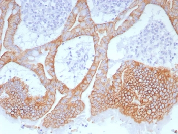 IHC staining of FFPE human colon tissue with Cytokeratin 20 antibody (clone Ks20.8). HIER: boil tissue sections in pH 9 10mM Tris with 1mM EDTA for 20 min and allow to cool before testing.