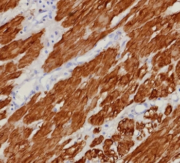 IHC staining of FFPE human uterus tissue with recombinant CNN1 antibody (clone rCNN1/9164). HIER: boil tissue sections in pH 9 10mM Tris with 1mM EDTA for 20 min and allow to cool before testing.