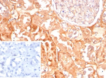 IHC staining of FFPE human kidney tissue with CASP7 antibody (clone CASP7/9053). Inset: PBS used in place of primary Ab (secondary Ab negative control). HIER: boil tissue sections in pH 9 10mM Tris with 1mM EDTA for 20 min and allow to cool before testing.