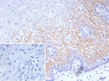 IHC staining of FFPE human esophagus tissue with recombinant Desmocollin-2/3 antibody (clone DSC2/9165R). Inset: PBS used in place of primary Ab (secondary Ab negative control). HIER: boil tissue sections in pH 9 10mM Tris with 1mM EDTA for 20 min and allow to cool before testing.