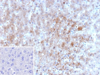 IHC staining of FFPE human liver tissue with ARK1C1 antibody (clone AKR1C1/9062). Inset: PBS used in place of primary Ab (secondary Ab negative control). HIER: boil tissue sections in pH 9 10mM Tris with 1mM EDTA for 20 min and allow to cool before testing.