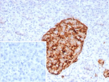 IHC staining of FFPE human pancreas tissue with recombinant GAD2 antibody (clone rGAD2/9382). Inset: PBS used in place of primary Ab (secondary Ab negative control). HIER: boil tissue sections in pH 9 10mM Tris with 1mM EDTA for 20 min and allow to cool before testing.