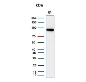 Western blot testing of human small intestine tissue lysate with recombinant CDH17 antibody. Predicted molecular weight ~92 kDa but may be observed at higher molecular weights due to glycosylation.