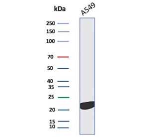 Western blot testing of human A549 cell lysate with Interleukin 18 antibody. Predicted molecular weight ~22 kDa.