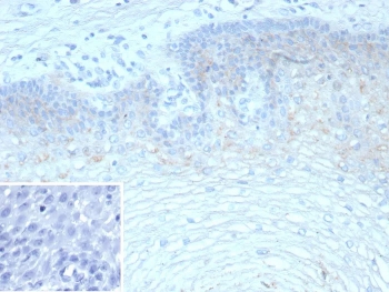 IHC staining of FFPE human esophagus tissue with recombinant Tripartite motif-containing protein 29 antibody (clone TRIM29/9257R). Inset: PBS used in place of primary Ab (secondary Ab negative control). HIER: boil tissue sections in pH 9 10mM Tris with 1mM EDTA for 20 min and allow to cool before testing.