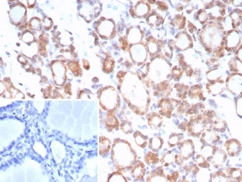 IHC staining of FFPE human thyroid tissue with TrkB antibody (clone NTRK2/7929). Inset: PBS used in place of primary Ab (secondary Ab negative control). HIER: boil tissue sections in pH 9 10mM Tris with 1mM EDTA for 20 min and allow to cool before testing.