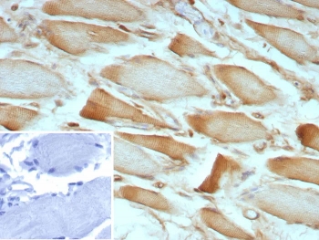 IHC staining of FFPE human skeletal muscle tissue with ZNF408A antibody (clone ZNF804A/8945). Inset: PBS used in place of primary Ab (secondary Ab negative control). HIER: boil tissue sections in pH 9 10mM Tris with 1mM EDTA for 20 min and allow to cool before testing.