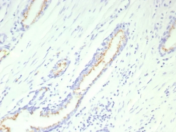 IHC staining of FFPE human prostate tissue with recombinant SLC45A3 antibody (clone SLC45A3/9216R). HIER: boil tissue sections in pH 9 10mM Tris with 1mM EDTA for 20 min and allow to cool before testing.