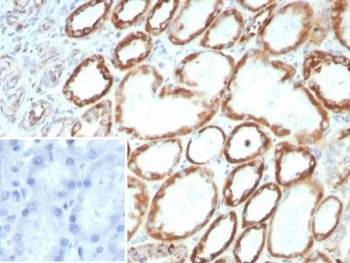 IHC staining of FFPE human kidney tissue with FGF23 antibody (clone FGF23/8939). Inset: PBS used in place of primary Ab (secondary Ab negative control). HIER: boil tissue sections in pH 9 10mM Tris with 1mM EDTA for 20 min and allow to cool before testing.