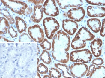 IHC staining of FFPE human kidney tissue with FGF23 antibody (clone FGF23/8940). Inset: PBS used in place of primary Ab (secondary Ab negative control). HIER: boil tissue sections in pH 9 10mM Tris with 1mM EDTA for 20 min and allow to cool before testing.