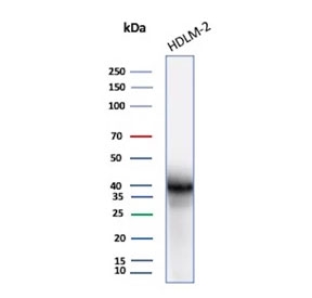 Western blot testing of human HDLM-2 cell lysate using recombinant PD-L1 antibody (clone rCD274/8195R). Predicted molecular weight ~34 kDa (unmodified), 45-70 kDa (glycosylated).