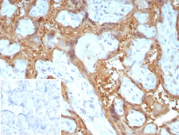 IHC staining of FFPE human placental tissue with Galectin-13 antibody (clone PP13/8897). Inset: PBS used in place of primary Ab (secondary Ab negative control). HIER: boil tissue sections in pH 9 10mM Tris with 1mM EDTA for 20 min and allow to cool before testing.