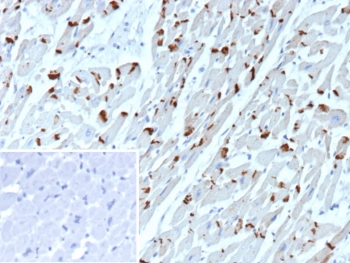 IHC staining of FFPE human heart tissue with Cadherin 2 antibody (clone CDH2/9491). Inset: PBS used in place of primary Ab (secondary Ab negative control). HIER: boil tissue sections in pH 9 10mM Tris with 1mM EDTA for 20 min and allow to cool before testing.