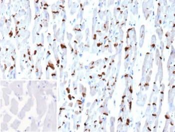 IHC staining of FFPE human heart tissue with Cadherin 2 antibody (clone CDH2/9494). Inset: PBS used in place of primary Ab (secondary Ab negative control). HIER: boil tissue sections in pH 9 10mM Tris with 1mM EDTA for 20 min and allow to cool before testing.