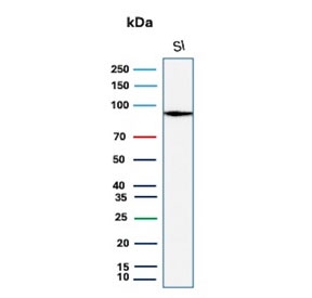 Western blot testing of human small intestine tissue lysate with LI-Cadherin antibody (clone CDH17/2614). Predicted molecular weight ~92 kDa but may be observed at higher molecular weights due to glycosylation.