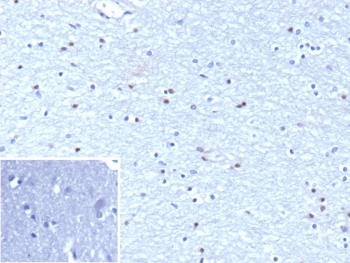 IHC staining of FFPE human brain tissue with Oligodendrocyte transcription factor 2 antibody (clone OLIG2/9995R). Inset: PBS used in place of primary Ab (secondary Ab negative control). HIER: boil tissue sections in pH 9 10mM Tris with 1mM EDTA for 20 min and allow to cool before testing.