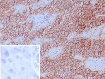 IHC staining of FFPE human tonsil tissue with Podoplanin antibody (clone D2-40). Inset: PBS used in place of primary Ab (secondary Ab negative control). HIER: boil tissue sections in pH 9 10mM Tris with 1mM EDTA for 20 min and allow to cool before testing.