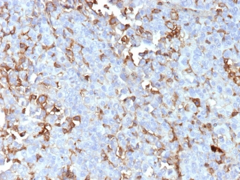 IHC staining of FFPE human adrenal gland tissue with Periostin antibody (clone POSTN/4095). HIER: boil tissue sections in pH 9 10mM Tris with 1mM EDTA for 20 min and allow to cool before testing.