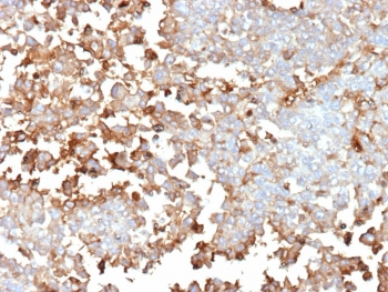 IHC staining of FFPE human adrenal gland tissue with Periostin antibody (clone POSTN/4096). HIER: boil tissue sections in pH 9 10mM Tris with 1mM EDTA for 20 min and allow to cool before testing.