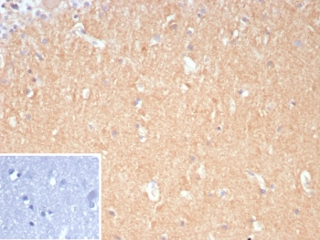 IHC staining of FFPE human brain tissue with DLL3 antibody (clone DLL3/9361). Inset: PBS used in place of primary Ab (secondary Ab negative control). HIER: boil tissue sections in pH 9 10mM Tris with 1mM EDTA for 20 min and allow to cool before testing.