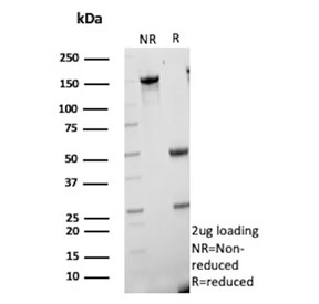 SDS-PAGE analysis of purified, BSA-free CETN1 antibody (clone CETN1/9878) as confirmation of integrity and purity.