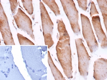 IHC staining of FFPE human skeletal muscle tissue with Cofilin 2 antibody (clone CFL2/9963). Inset: PBS used in place of primary Ab (secondary Ab negative control). HIER: boil tissue sections in pH 9 10mM Tris with 1mM EDTA for 20 min and allow to cool before testing.