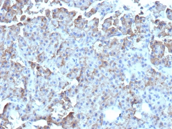 IHC staining of FFPE human parathyroid tissue with CD109 antibody (clone CD109/9947). HIER: boil tissue sections in pH 9 10mM Tris with 1mM EDTA for 20 min and allow to cool before testing.