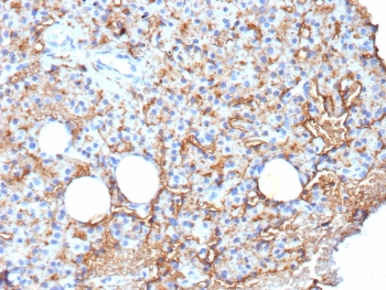 IHC staining of FFPE human parathyroid tissue with CD109 antibody (clone CD109/9949). HIER: boil tissue sections in pH 9 10mM Tris with 1mM EDTA for 20 min and allow to cool before testing.
