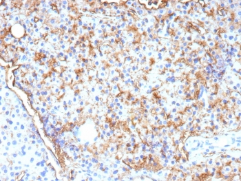 IHC staining of FFPE human parathyroid tissue with CD109 antibody (clone CD109/9955). HIER: boil tissue sections in pH 9 10mM Tris with 1mM EDTA for 20 min and allow to cool before testing.