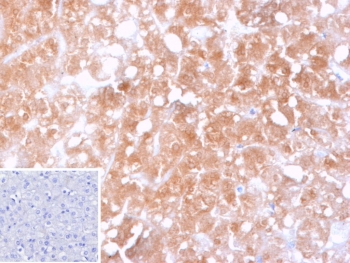 IHC staining of FFPE human hepatocellular carcinoma tissue with CYP2C9 antibody (clone CYP2C9/13121). Inset: PBS used in place of primary Ab (secondary Ab negative control). HIER: boil tissue sections in pH 9 10mM Tris with 1mM EDTA for 20 min and allow to cool before testing.