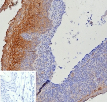 IHC staining of FFPE human tonsil tissue with Tissue Factor antibody (clone CD142/9195). Inset: PBS used in place of primary Ab (secondary Ab negative control). HIER: boil tissue sections in pH 9 10mM Tris with 1mM EDTA for 20 min and allow to cool before testing.