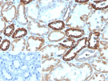 IHC staining of FFPE human kidney tissue with PLA2R1 antibody (clone PLA2R1/4891). Inset: PBS used in place of primary Ab (secondary Ab negative control). HIER: boil tissue sections in pH 9 10mM Tris with 1mM EDTA for 20 min and allow to cool before testing.