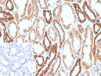 IHC staining of FFPE human kidney tissue with Phospholipase A2 receptor 1 antibody (clone PLA2R1/4894). Inset: PBS used in place of primary Ab (secondary Ab negative control). HIER: boil tissue sections in pH 9 10mM Tris with 1mM EDTA for 20 min and allow to cool before testing.