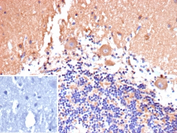 IHC staining of FFPE human brain tissue with CD135 antibody (clone FLT3/9889). Inset: PBS used in place of primary Ab (secondary Ab negative control). HIER: boil tissue sections in pH 9 10mM Tris with 1mM EDTA for 20 min and allow to cool before testing.