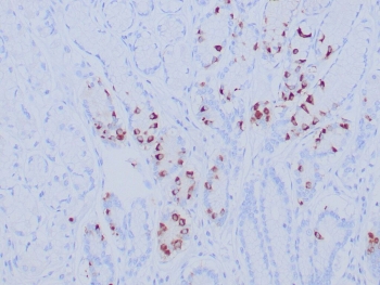 IHC staining of FFPE human gastric antrum tissue with recombinant Gastrin antibody (clone GAST/8646R). Inset: PBS used in place of primary Ab (secondary Ab negative control). HIER: boil tissue sections in pH 9 10mM Tris with 1mM EDTA for 20 min and allow to cool before testing.
