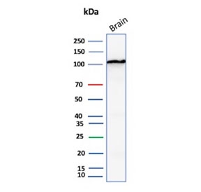 Western blot testing of human brain tissue lysate with Hexokinase 1 antibody (clone HK1/9515). Predicted molecular weight ~120 kDa.