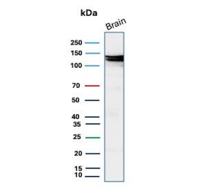 Western blot testing of human brain tissue lysate with Hexokinase 1 antibody (clone HK1/9517). Predicted molecular weight ~120 kDa.